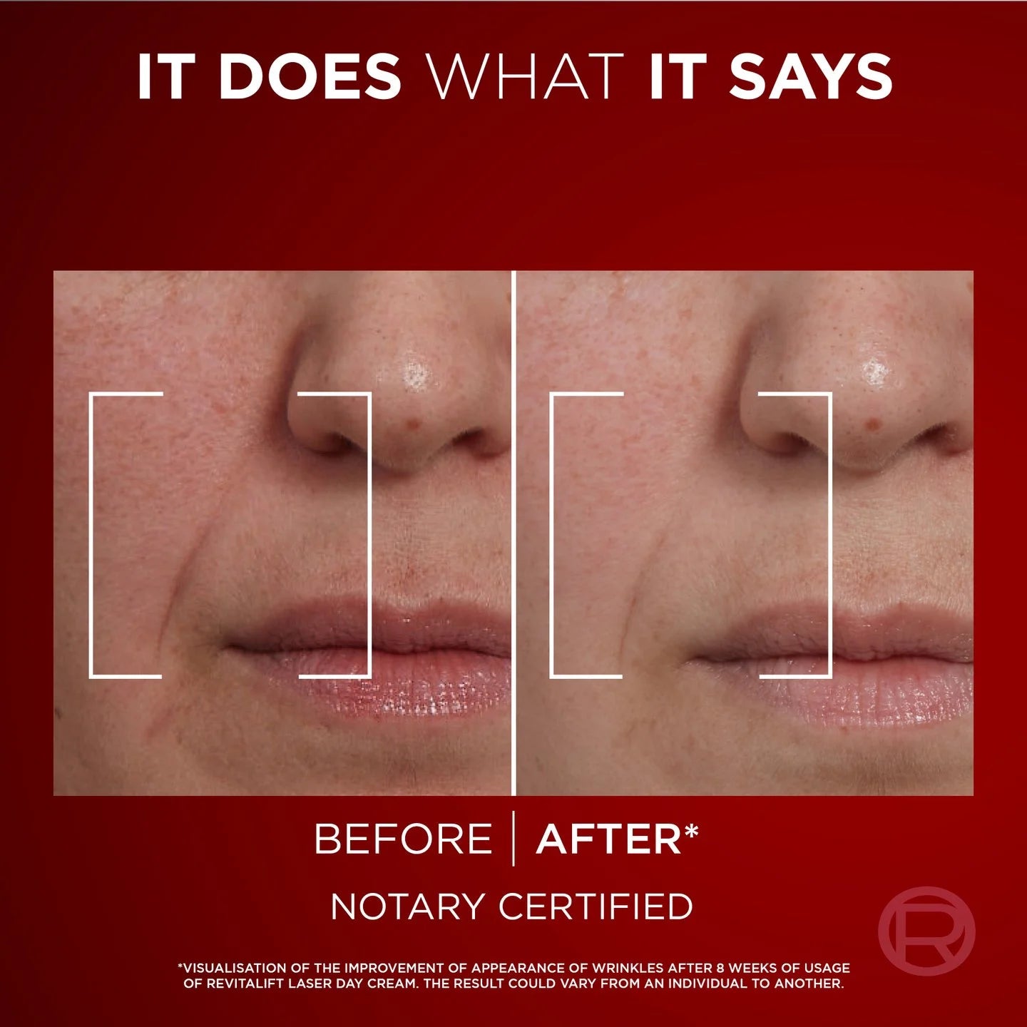 Before and after comparison of skin with text 'It does what it says' on a red background