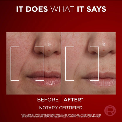 Before and after comparison of skin with text 'It does what it says' on a red background