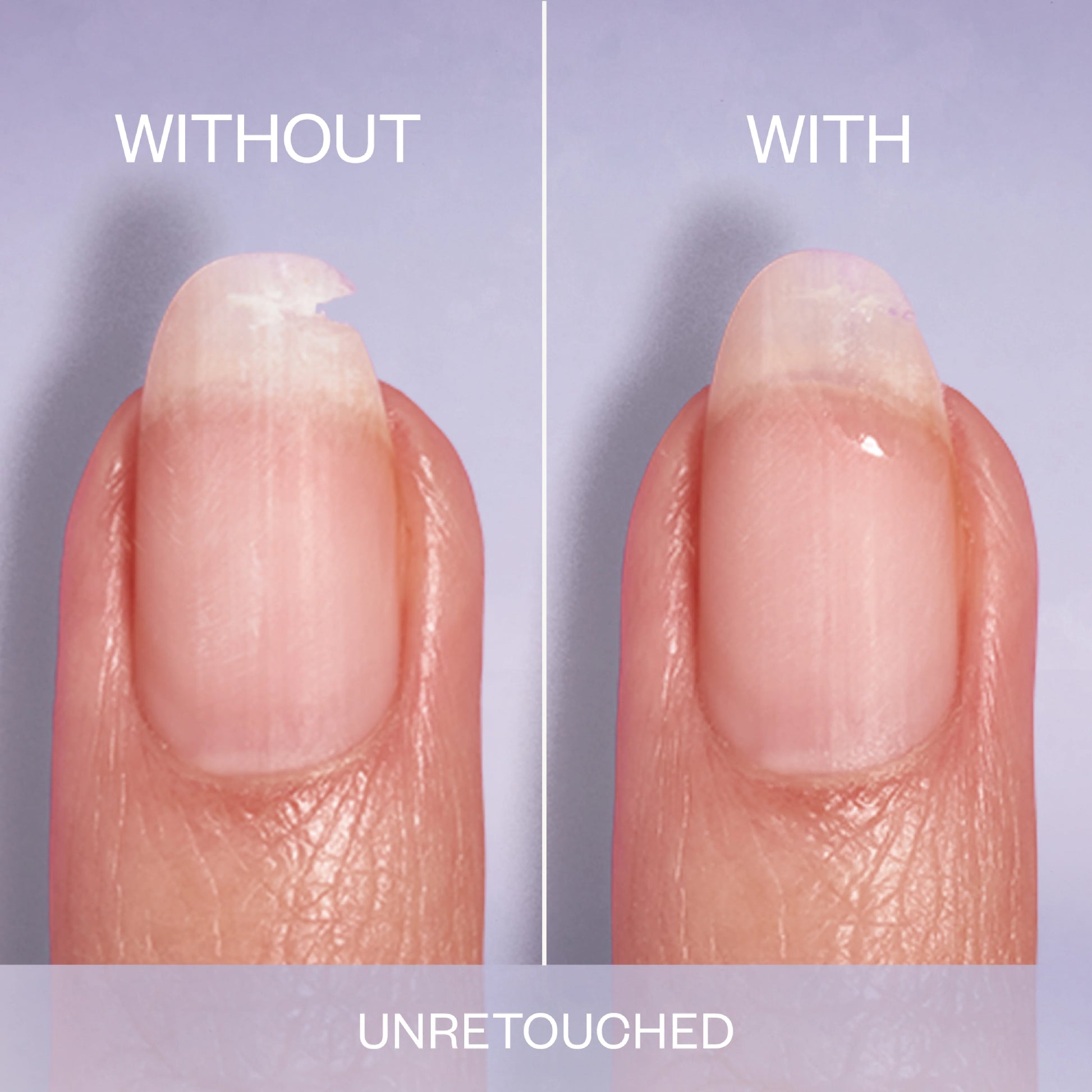 Comparison of a fingernail with and without a repair treatment on a purple background.