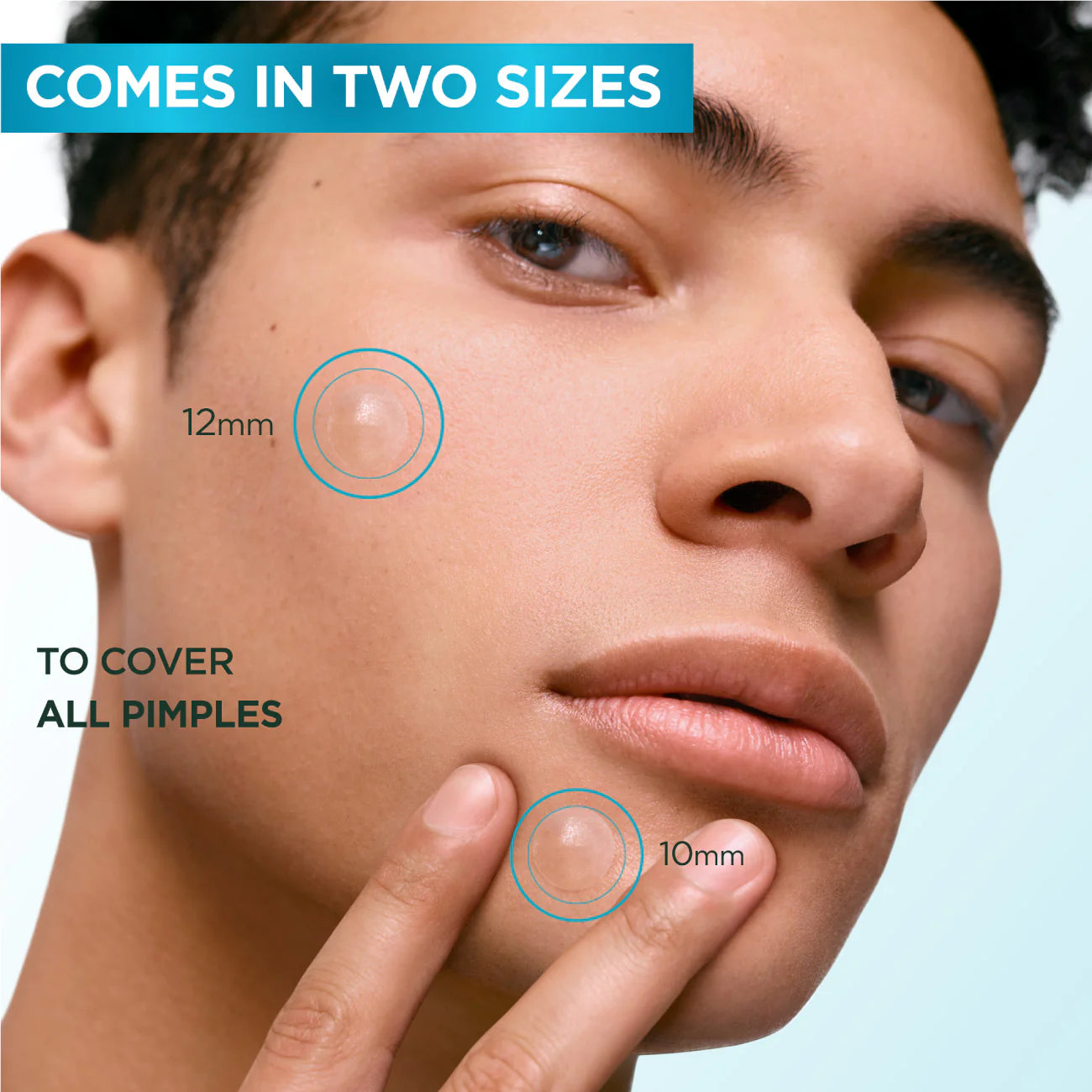 Close-up of a person's face with pimple sizes indicated, labeled '12mm' and '10mm', on a light blue background.