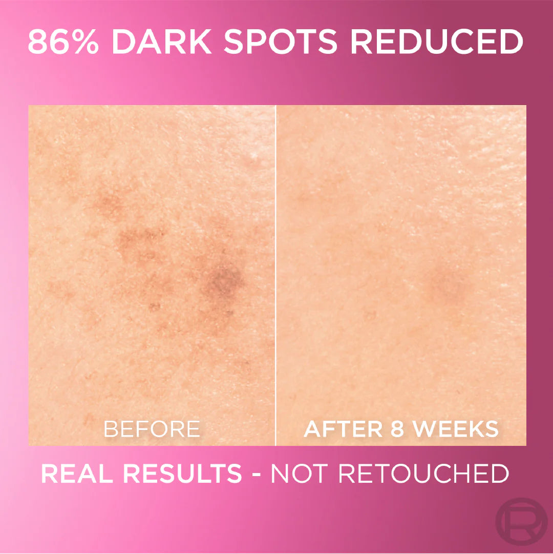 L’Oréal Paris Glycolic Bright Anti Dark Spot Brightening Serum - 30ml